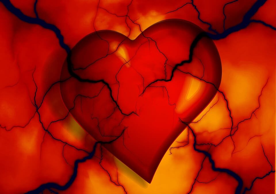 What is Coronary Artery Disease (CAD)?
