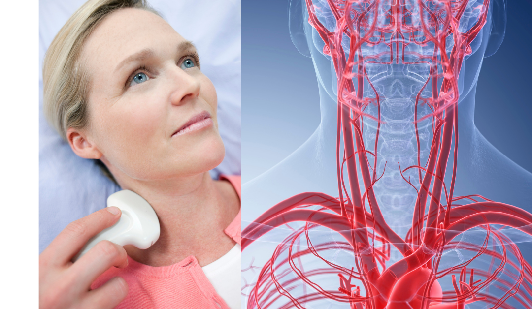 Carotid Artery Duplex Scan