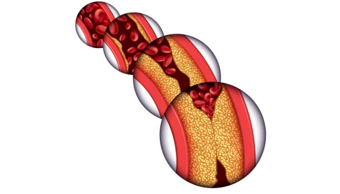 Blood pressure shop and cholesterol