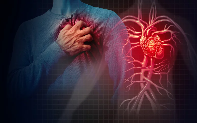 How is Sudden Cardiac Dysfunction (SCD) different from a heart attack?